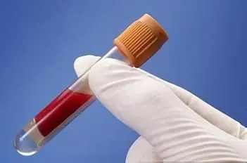 乙肝表面抗体阳性是什么意思会传染吗