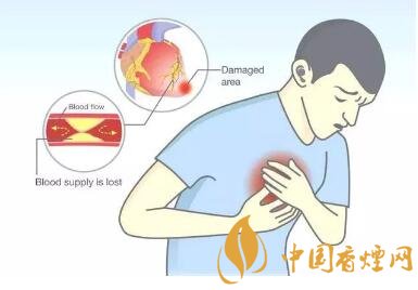 吸烟的两大主要危害 拒绝健康被烟没!